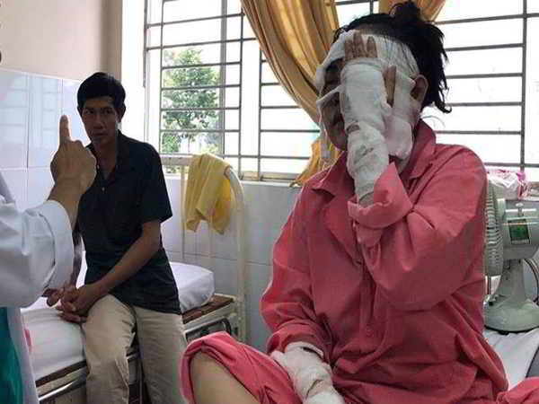 Cô gái sắp kết hôn bị tạt axit đến hỏng hai mắt